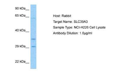 Western Blot: SLC39A3 Antibody [NBP2-88304]