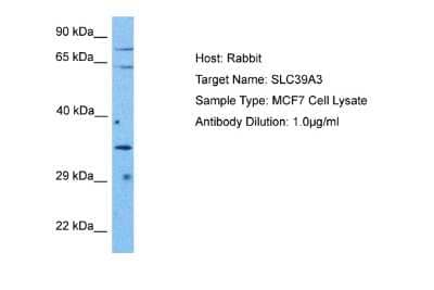 Western Blot: SLC39A3 Antibody [NBP2-88305]