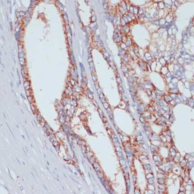 Immunohistochemistry-Paraffin: SLC39A4/ZIP4 Antibody - BSA Free [NBP2-94856]