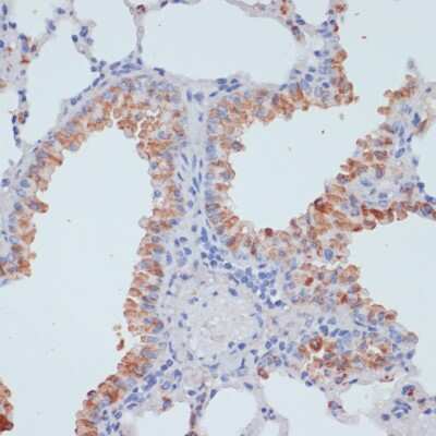 Immunohistochemistry-Paraffin: SLC39A4/ZIP4 Antibody - BSA Free [NBP2-94856]