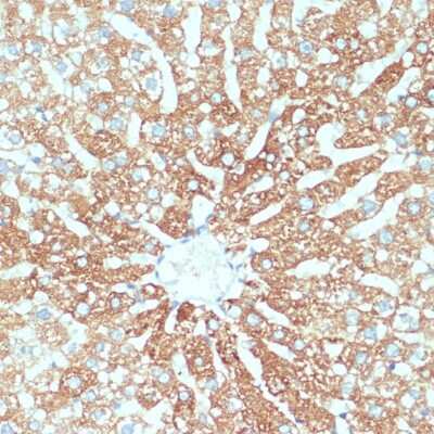 Immunohistochemistry-Paraffin: SLC39A4/ZIP4 Antibody - BSA Free [NBP2-94856]