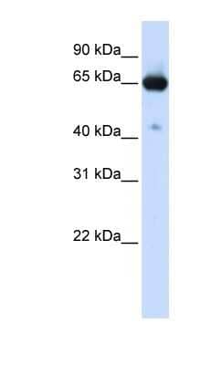 Western Blot: SLC39A4/ZIP4 Antibody [NBP1-59789]