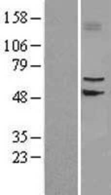 Western Blot: SLC39A4/ZIP4 Overexpression Lysate [NBL1-16147]