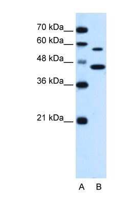 Western Blot: SLC39A5 Antibody [NBP1-69296]