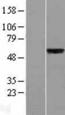 Western Blot: SLC39A5 Overexpression Lysate [NBL1-16149]