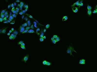 Immunocytochemistry/ Immunofluorescence: SLC39A7/ZIP7 Antibody [NBP2-97151]