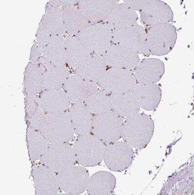 Immunohistochemistry-Paraffin: SLC39A7/ZIP7 Antibody [NBP2-13338]