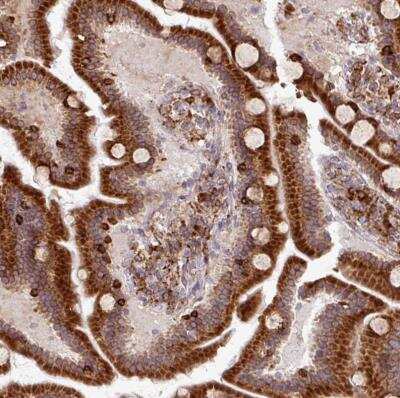 Immunohistochemistry-Paraffin: SLC39A7/ZIP7 Antibody [NBP2-13338]