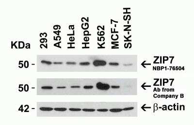 Western Blot: SLC39A7/ZIP7 AntibodyBSA Free [NBP1-76504]