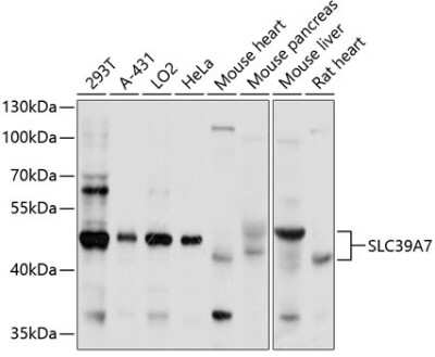 Western Blot: SLC39A7/ZIP7 AntibodyBSA Free [NBP2-94849]