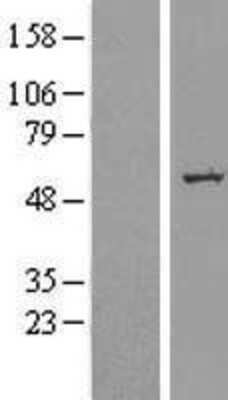 Western Blot: SLC39A7/ZIP7 Overexpression Lysate [NBL1-16150]