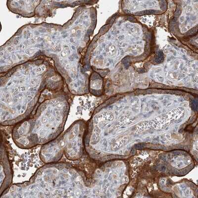 Immunohistochemistry-Paraffin: SLC39A8/ZIP8 Antibody [NBP1-88605]