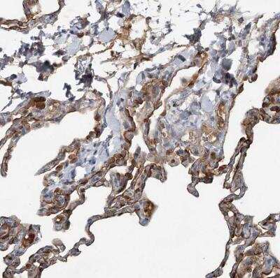 Immunohistochemistry-Paraffin: SLC39A8/ZIP8 Antibody [NBP2-34058]
