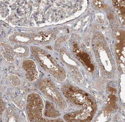 Immunohistochemistry-Paraffin: SLC39A8/ZIP8 Antibody [NBP2-34058]