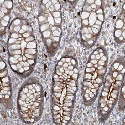 Immunohistochemistry-Paraffin: SLC39A8/ZIP8 Antibody [NBP2-34058]
