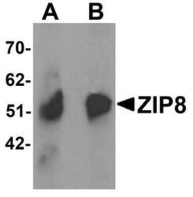 Western Blot: SLC39A8/ZIP8 AntibodyBSA Free [NBP1-76505]