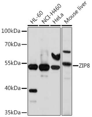 Western Blot: SLC39A8/ZIP8 AntibodyBSA Free [NBP2-93479]