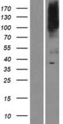 Western Blot: SLC39A8/ZIP8 Overexpression Lysate [NBP2-04389]