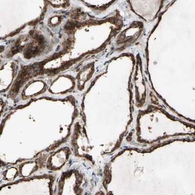 Immunohistochemistry-Paraffin: SLC39A9/ZIP9 Antibody [NBP1-83760]