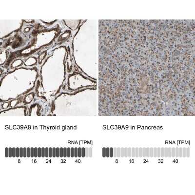 Immunohistochemistry-Paraffin: SLC39A9/ZIP9 Antibody [NBP1-83760]