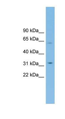 Western Blot: SLC39A9/ZIP9 Antibody [NBP1-59841]