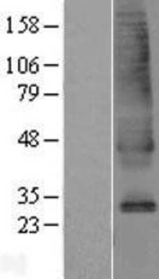 Western Blot: SLC39A9/ZIP9 Overexpression Lysate [NBL1-16152]