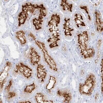 Immunohistochemistry-Paraffin: SLC3A1 Antibody [NBP2-47272]