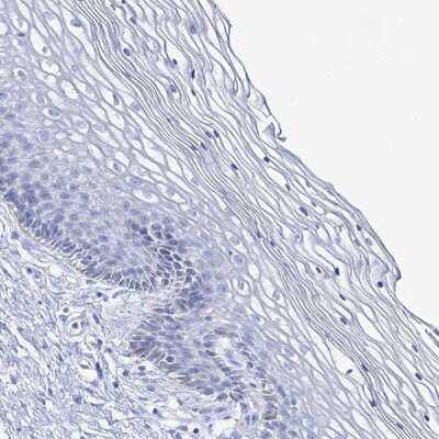 Immunohistochemistry-Paraffin: SLC3A1 Antibody [NBP2-47272]