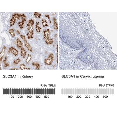 Immunohistochemistry-Paraffin: SLC3A1 Antibody [NBP2-47272]