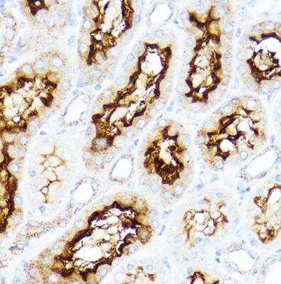 Immunohistochemistry-Paraffin: SLC3A1 Antibody - BSA Free [NBP2-93116]
