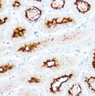 Immunohistochemistry-Paraffin: SLC3A1 Antibody - BSA Free [NBP2-93116]