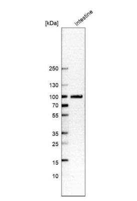 Western Blot: SLC3A1 Antibody [NBP2-47272]
