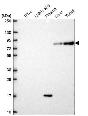 Western Blot: SLC3A1 Antibody [NBP2-68912]