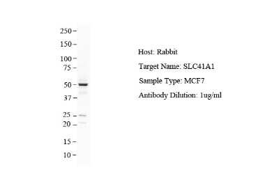 Western Blot: SLC41A1 Antibody [NBP1-59693]