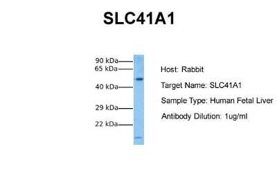 Western Blot: SLC41A1 Antibody [NBP1-59693]