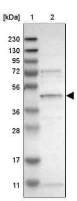 Western Blot: SLC41A1 Antibody [NBP1-82652]