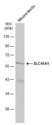 Western Blot: SLC41A1 Antibody [NBP3-13041]