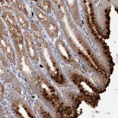 Immunohistochemistry-Paraffin: SLC41A2 Antibody [NBP1-85116]