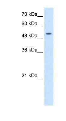 Western Blot: SLC41A2 Antibody [NBP1-59683]