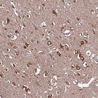 Immunohistochemistry-Paraffin: SLC41A3 Antibody [NBP2-48837]