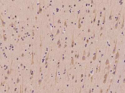 Immunohistochemistry-Paraffin: SLC41A3 Antibody [NBP2-97860]