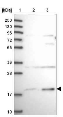 Western Blot: SLC41A3 Antibody [NBP2-48837]