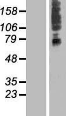 Western Blot: SLC41A3 Overexpression Lysate [NBL1-16156]