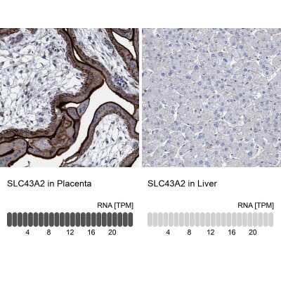 Immunohistochemistry-Paraffin: SLC43A2 Antibody [NBP1-82706]