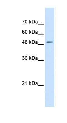 Western Blot: SLC43A2 Antibody [NBP1-59373]