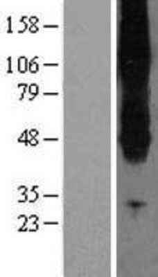 Western Blot: SLC43A2 Overexpression Lysate [NBL1-16158]