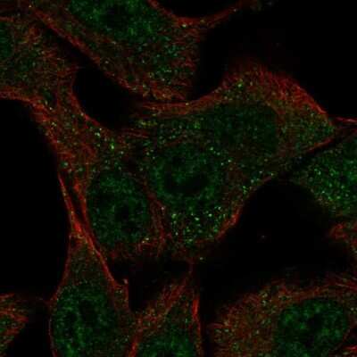 Immunocytochemistry/ Immunofluorescence: SLC43A3 Antibody [NBP2-69032]