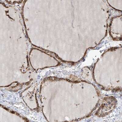 Immunohistochemistry-Paraffin: SLC43A3 Antibody [NBP1-85026]