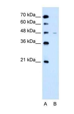 Western Blot: SLC43A3 Antibody [NBP1-69535]