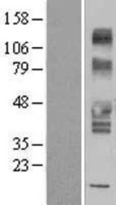 Western Blot: SLC43A3 Overexpression Lysate [NBP2-07378]